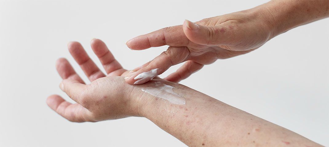 Seb hidratálása vazelinnel vagy aloeverával