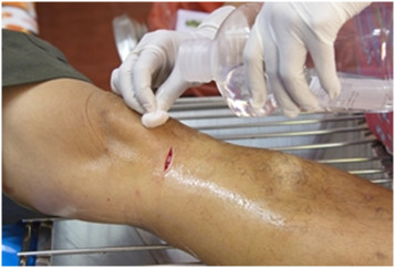 Fotó: advancedtissue.com